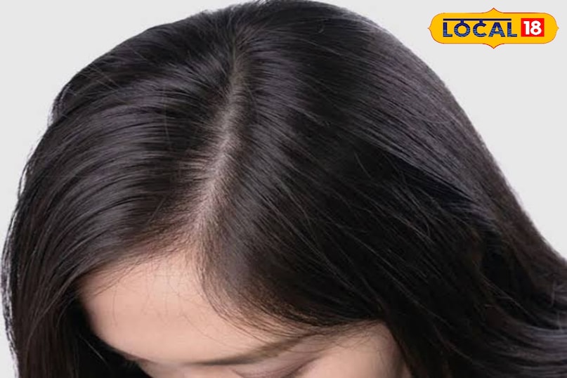5. Keeps the scalp healthy. Bhendi has anti-inflammatory properties, which reduce scalp infection, itching and dandruff. This keeps the scalp healthy and grows hair well. 5. Keeps the scalp healthy. Bhendi has anti-inflammatory properties, which reduce scalp infection, itching and dandruff. This keeps the scalp healthy and grows hair well.