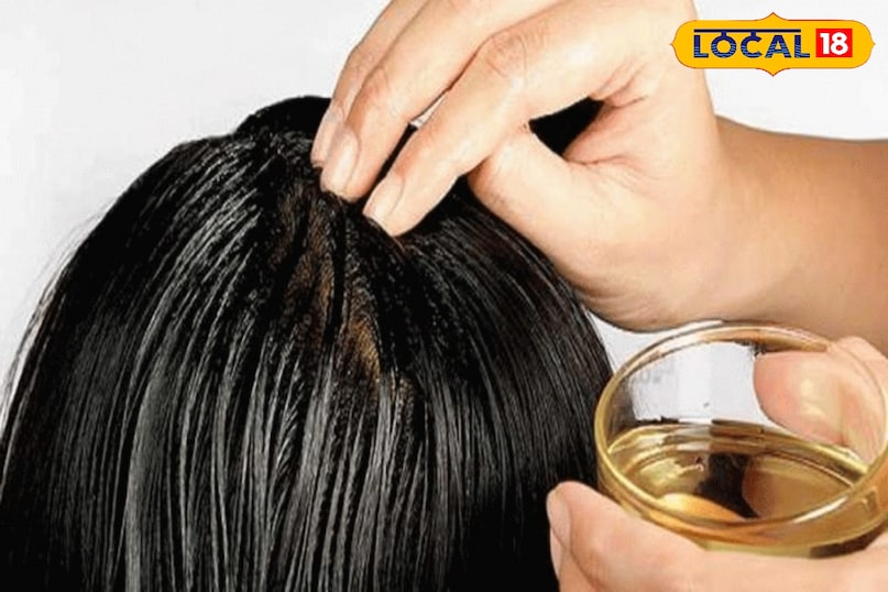 Monsoon hair care tips, Hair fall and dandruff solution, Home remedies, local18, khargone letest news, Madhya Pradesh hindi news 