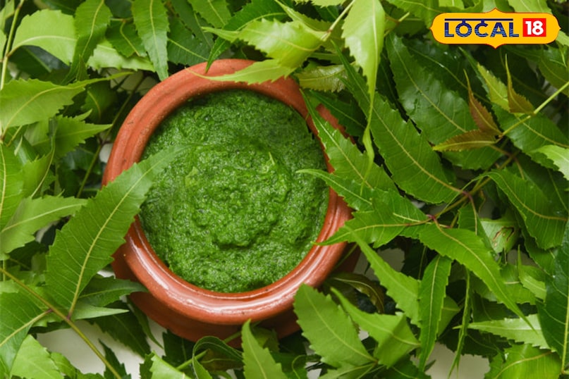 Home remedies for dandruff, Monsoon hair care tips, Hair fall and dandruff solution, Home remedies, local18, khargone letest news, Madhya Pradesh hindi news 