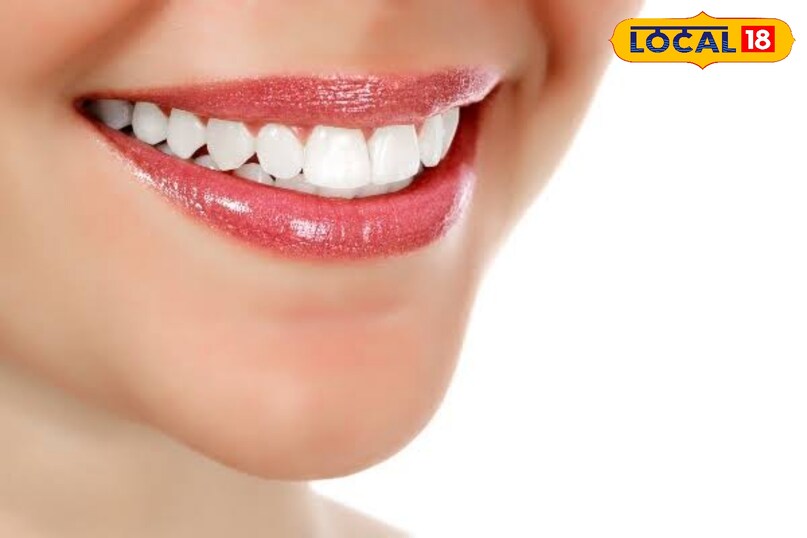 स्वस्थ दांतों के लक्षण क्या हैं मजबूत और चमकदार भले ही हल्के पीले हों, मसूड़े गुलाबी और फर्म हो, सांसों में बदबू न हो और दर्द या सेंसिटिविटी न हो तब आपके दांत स्वस्थ हैं 