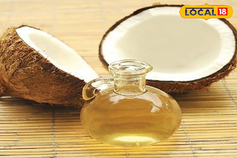Home Remedies for Baldness, Hair Fall Treatment, Natural Treatment for Hair Loss, Tips and Trick, Local18, Khargone Letest News, Madhya Pradesh Hindi News Home Remedies for Baldness, Hair Fall Treatment, Natural Treatment for Hair Loss, Tips and Trick, Local18, Khargone Letest News, Madhya Pradesh Hindi News
