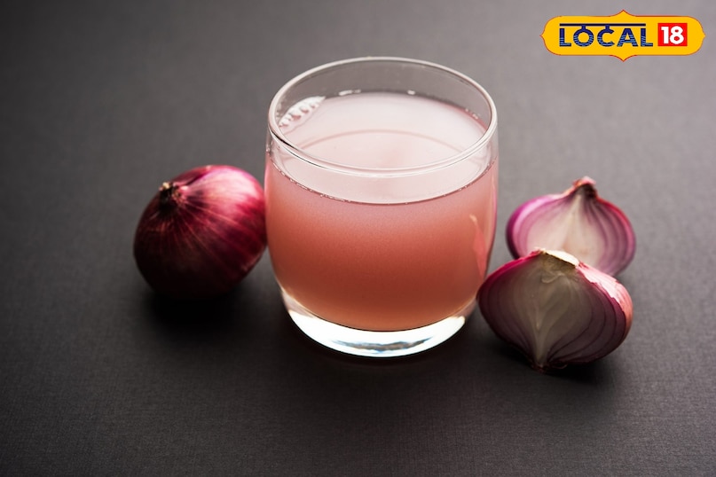 Home Remedies for Baldness, Hair Fall Treatment, Natural Treatment for Hair Loss, Tips and Trick, Local18, Khargone Letest News, Madhya Pradesh Hindi News Home Remedies for Baldness, Hair Fall Treatment, Natural Treatment for Hair Loss, Tips and Trick, Local18, Khargone Letest News, Madhya Pradesh Hindi News