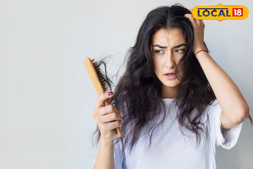 Home Remedies for Baldness, Hair Fall Treatment, Natural Treatment for Hair Loss, Tips and Trick, Local18, Khargone Letest News, Madhya Pradesh Hindi News 