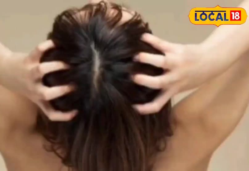 Hair tips, healthy hair tips, monsoon hair tips, remedy for itchy scalp, treatment for itchy scalp, hair tips, healthy hair tips, monsoon hair tips, head itching remedy, head itching treatment