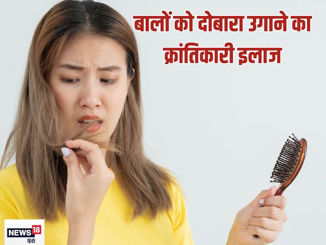 न ट्रांसप्लांट की जरूरत न दवा खाने की, वैज्ञानिकों ने खोज ली गंजे सिर पर बाल लगाने की विधि, जानें कैसे दोबारा उगेंगे हेयर