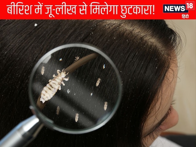 Scalp is necessary in monsoon, otherwise it can be a victim of lice Scalp is necessary in monsoon, otherwise it can be a victim of lice