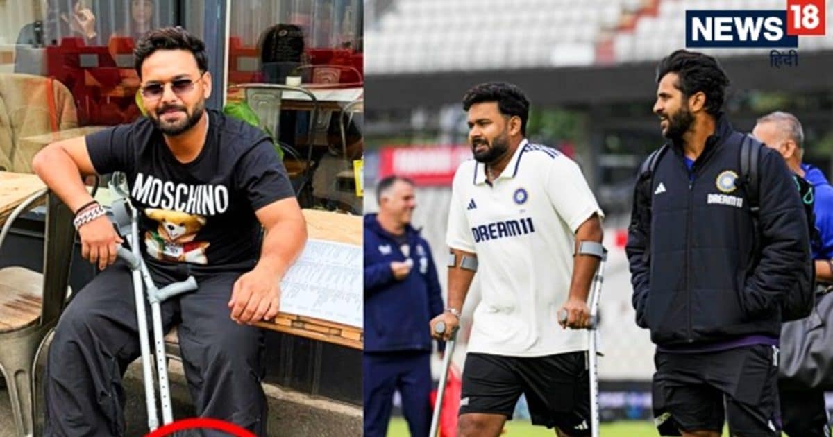 Rishabh Pant Reveals Plastered Leg : ऋषभ पंत ने शेयर की प्लास्टर लगे पैर की तस्वीर