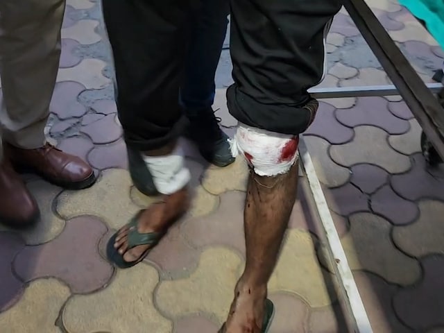 पुलिस पर धांय-धांय 20 गोलियां चलाई, जवाबी एक्शन में दो शूटर्स घायल पुलिस पर धांय-धांय 20 गोलियां चलाई, जवाबी एक्शन में दो शूटर्स घायल