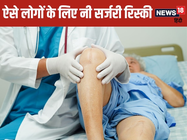घुटने की सर्जरी कराने का है प्लान? जरूर पढ़ लें यह खबर, इंफेक्शन से बचने में मिलेगी मदद ! नई स्टडी में खुलासा