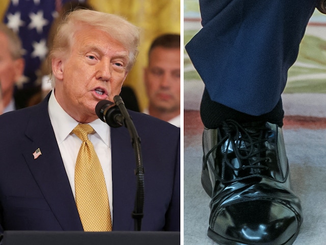 Donald Trump saw swelling in his feet, new disease received on conducting examination, know Donald Trump saw swelling in his feet, new disease received on conducting examination, know