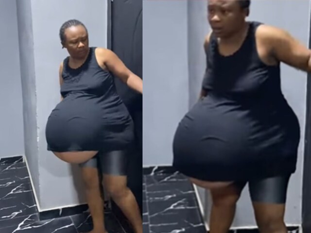 A woman's stomach started flourishing like a balloon, the doctor was shocked as an ultrasound!