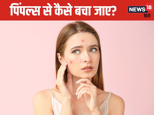 क्या बारिश में बढ़ जाती है पिंपल्स की समस्या? अगर आपको भी यह परेशानी, तो जरूर पढ़ें यह खबर