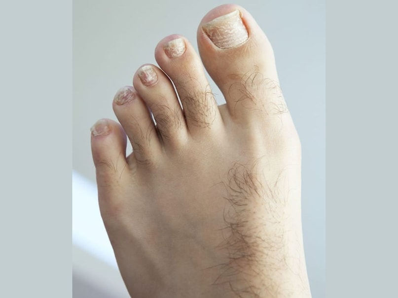 যদি আপনার পায়ের দ্বিতীয় আঙুলটি বৃদ্ধাঙ্গুলির চেয়ে বড় হয় এবং তার পরে আঙুলগুলি যথাক্রমে ছোট হয়, তাহলে এই ধরনের ব্যক্তিরা তাদের কঠোর পরিশ্রমের মাধ্যমে তাদের ভাগ্য পরিবর্তন করতে পারেন। যদি আপনার পায়ের দ্বিতীয় আঙুলটি বৃদ্ধাঙ্গুলির চেয়ে বড় হয় এবং তার পরে আঙুলগুলি যথাক্রমে ছোট হয়, তাহলে এই ধরনের ব্যক্তিরা তাদের কঠোর পরিশ্রমের মাধ্যমে তাদের ভাগ্য পরিবর্তন করতে পারেন।