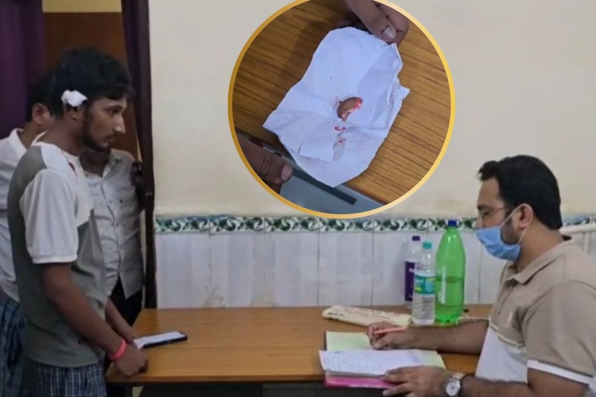 प्यार से पाला कुत्ता बना खतरा डांट लगाने पर डॉगी ने काट लिया मालिक का कान
