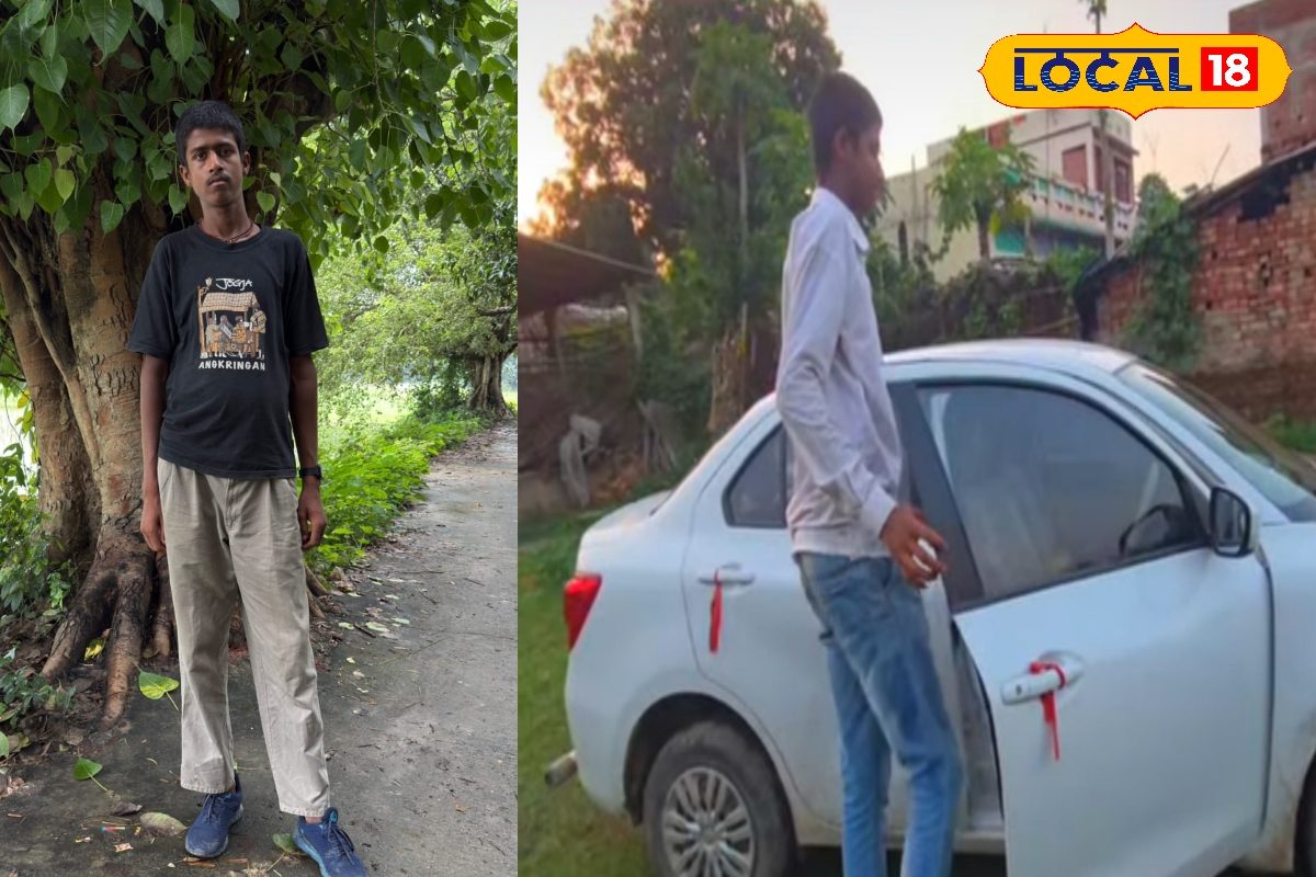 उम्र 15...लंबाई 8 फीट! न जींस मिलता, न बेड पर समाते, जानें कैसे जी रहा 'लंबू'