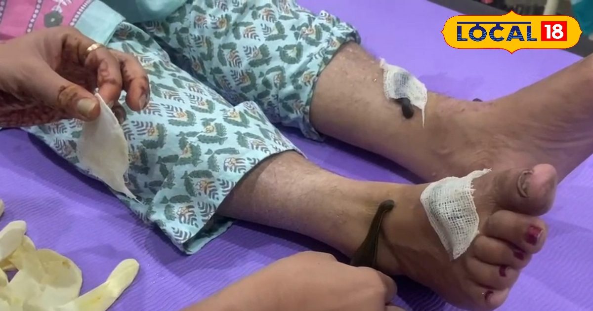 ये खतरनाक कीड़ा बॉडी से निकाल देगा खराब खून… 70 रुपए में सूजन, दर्द होगा छूमंतर! जानें विधि
