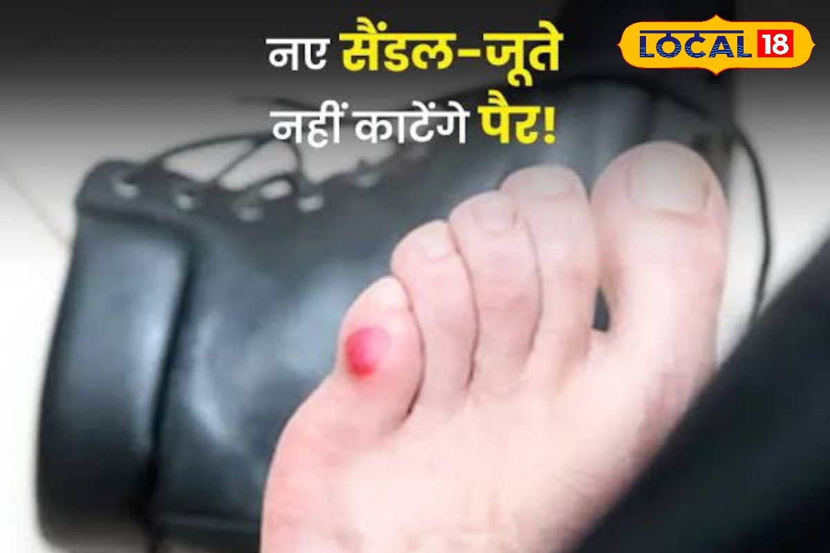 नये जूते-चप्पल से अब नहीं कटेंगे पैर, एक्सपर्ट ने बताए देसी जुगाड़