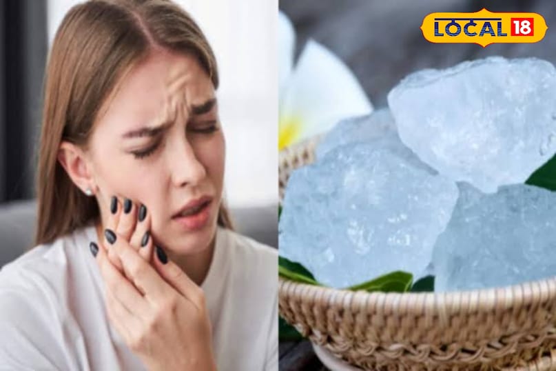चेहरे के मुहांसे हो जाएंगे गायब