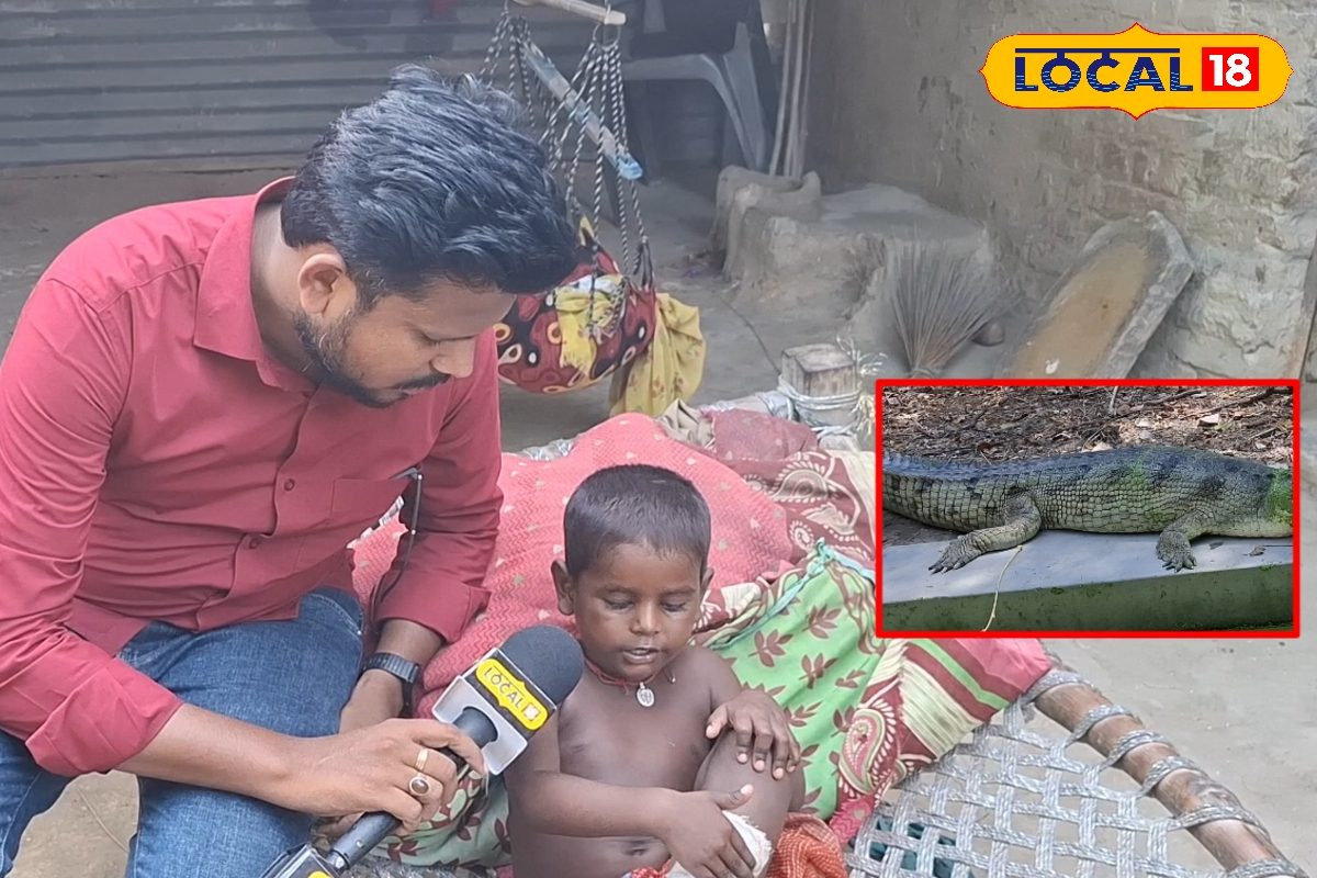 मासूम की दहला देने वाली आपबीती, नहर से निकलकर मगरमच्छ ने दबोचा पैर, फिर...