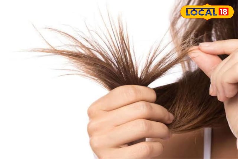 दूसरा फायदा स्प्लिट एंड्स कम करे बालों के सिरों पर रोजाना थोड़ी मात्रा में बाओबाब तेल लगाएं। ऐसा करने से स्प्लिट एंड्स कम होते हैं और बालों के टिप्स हेल्दी रहते हैं। अगर रोजाना इसे लगाना संभव न हो, तो बाल धोने से पहले भी इसे इस्तेमाल कर सकते हैं। दूसरा फायदा स्प्लिट एंड्स कम करे बालों के सिरों पर रोजाना थोड़ी मात्रा में बाओबाब तेल लगाएं। ऐसा करने से स्प्लिट एंड्स कम होते हैं और बालों के टिप्स हेल्दी रहते हैं। अगर रोजाना इसे लगाना संभव न हो, तो बाल धोने से पहले भी इसे इस्तेमाल कर सकते हैं।