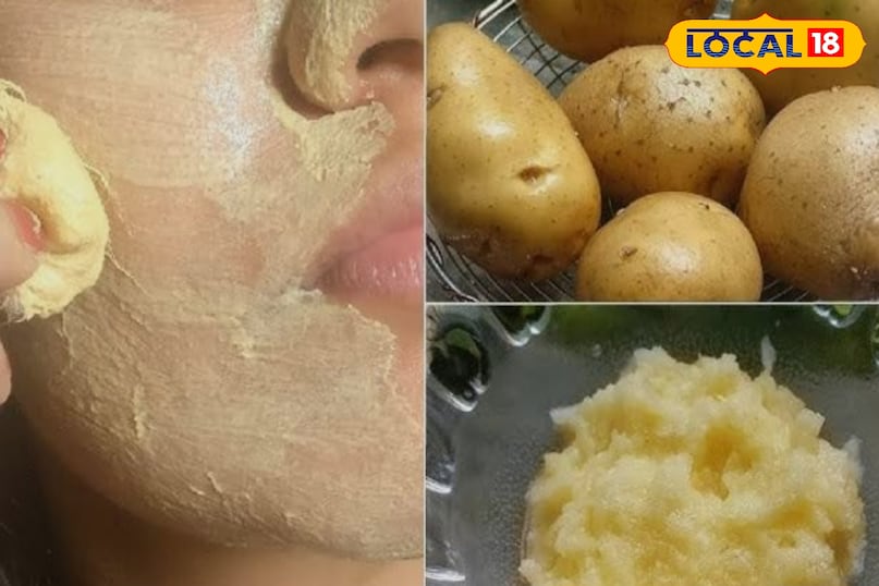 आलू के रस का मसाज आलू के रस का मसाज