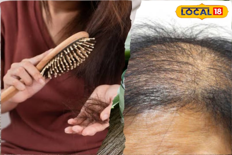बाल झड़ना एक आम समस्या हो गई है जिससे हर कोई परेशान नज़र आता है जैसे ही आपके सर से बाल झड़ना शुरू होते है आपको गंजेपन का डर सताने लगता है इस डर से आप महंगी महंगी दवाई लेना शहर कर देते है लेकिन फिर भी बाल झड़ना कम नहीं होते है एसे अगर आपके बाल पूरी तरह से झड़ चुके हैं तो इन घरेलू नुस्खों की मदद से आप उन्हें एक बार फिर से उगा सकते हैं।