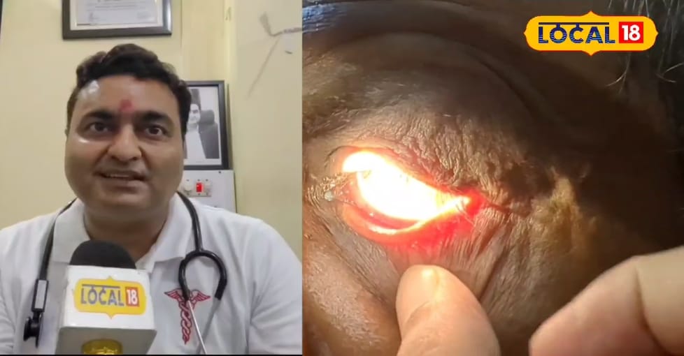 डॉक्टर हो तो अनीश जैसा... गरीब मरीजों का फ्री में करते हैं इलाज, जानें वजह