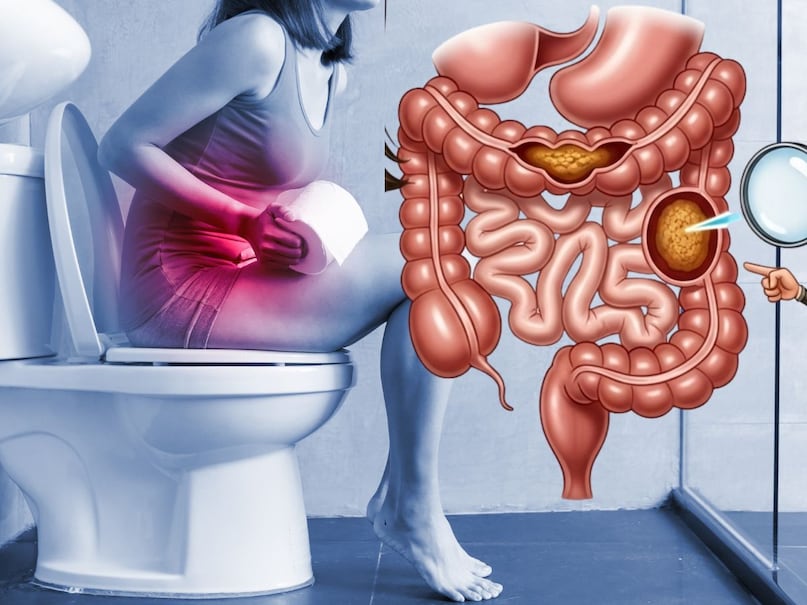 হিন্দিতে যেভাবে পেট পরিষ্কার রাখবেন: শীতের মৌসুমে পেট খারাপের সম্ভাবনা বেড়ে যায়। পেটের সমস্যায় অনেক ধরনের সমস্যা হতে পারে। তবে অনেকেই কোষ্ঠকাঠিন্য থেকে মুক্তি পাওয়ার জন্য ওষুধ খান কিন্তু ওষুধ স্বাস্থ্যের অনেক ক্ষতি করে। তাই এই প্রাকৃতিক পানীয়টি আপনার খাদ্যতালিকায় অন্তর্ভুক্ত করলে তা পেট পরিষ্কার করতে সাহায্য করতে পারে। এই পানীয়টির সবচেয়ে ভালো দিক হল এটি বাড়িতে সহজেই তৈরি করা যায়। এটি আপনার পেটের স্বাস্থ্যের উন্নতি করে এবং আপনার সামগ্রিক স্বাস্থ্যের উপকার করে। তো চলুন জেনে নিই কিভাবে বাড়িতে তৈরি করবেন...