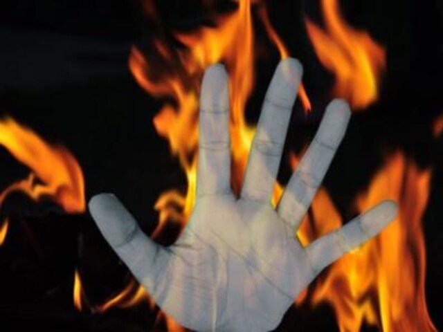 बरगढ़ में 8वीं की छात्रा ने की आत्मदाह की कोशिश! हालत गंभीर