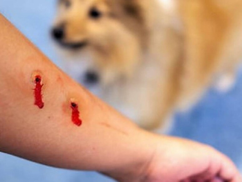 why rabies is deadly, why rabies is fatal, knowledge news for rabies 