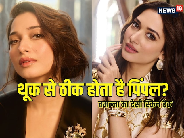 Will Pimple go from spit? People surprised at this skin care hack of Tamnna Bhatia! Will Pimple go from spit? People surprised at this skin care hack of Tamnna Bhatia!
