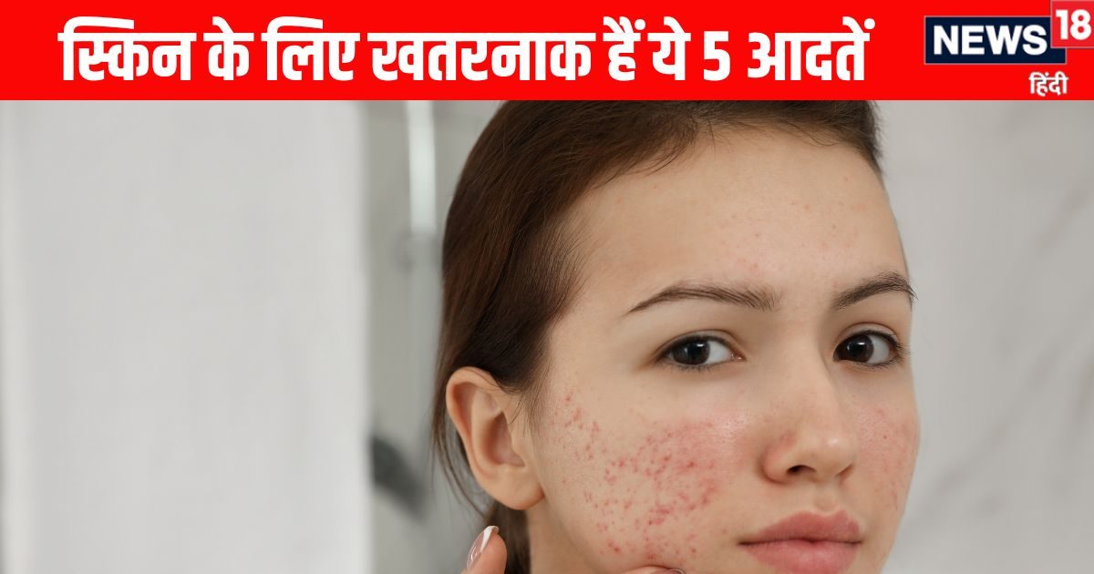 स्किन को बूढ़ा बना देंगी आपकी ये 5 गलत आदतें, चेहरा भर जाएगा एक्ने, पिगमेंटेनश और झुर्रियों से, मान लें एक्सपर्ट की ये बात