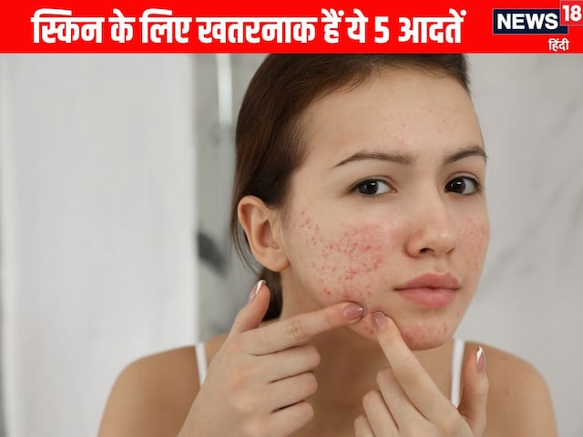 स्किन को बूढ़ा बना देंगी आपकी ये 5 आदतें, चेहरा भर जाएगा एक्ने, झुर्रियों से स्किन को बूढ़ा बना देंगी आपकी ये 5 आदतें, चेहरा भर जाएगा एक्ने, झुर्रियों से