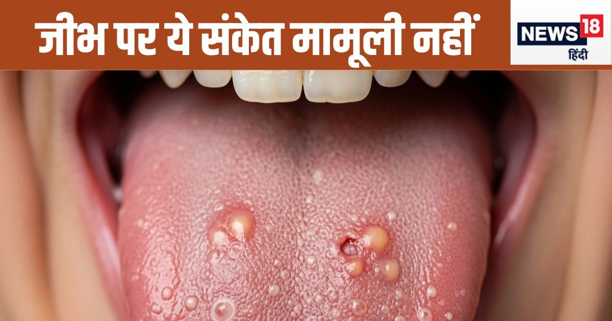 जीभ पर ये 5 संकेत मामूली नहीं, हर एक से होती हो सकती है अलग-अलग बीमारियां, कैंसर का भी खतरा