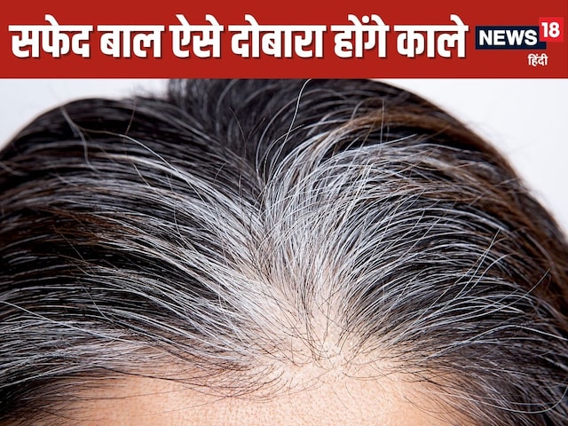 White Hair Remedy: नारियल तेल में मिलाकर लगाएं 4 चीजें, सफेद बाल होंगे काले !