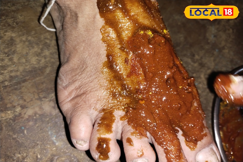 दर्द से राहत मिलेगी दर्द से राहत मिलेगी