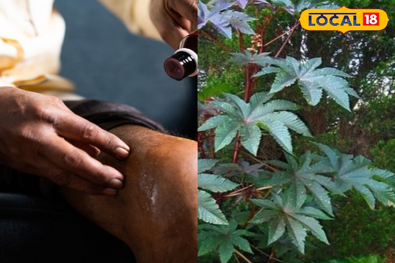 मेरठ, आयुर्वेद, अरंडी के पत्ते, दर्द, गठिया, समाधान, उपयोग, हल्दी, तेल, लोकल -18 ,Meerut, Ayurveda, castor leaves, pain, arthritis, solution, use, turmeric, oil, local-18 मेरठ, आयुर्वेद, अरंडी के पत्ते, दर्द, गठिया, समाधान, उपयोग, हल्दी, तेल, लोकल -18 ,Meerut, Ayurveda, castor leaves, pain, arthritis, solution, use, turmeric, oil, local-18