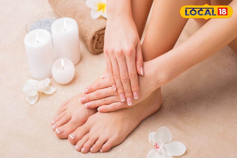 Home remedies: easy solution for cracked heels