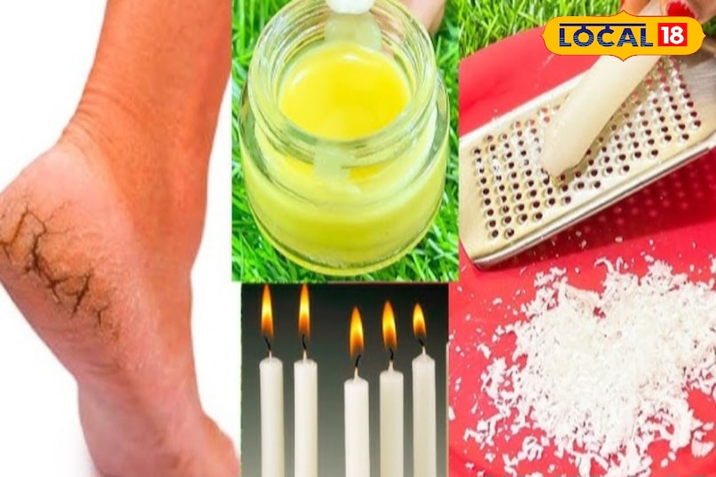 Helpful in repairing cracked heels