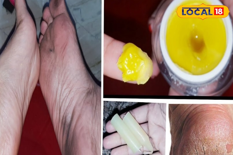 Moisturizes and repairs heels 
