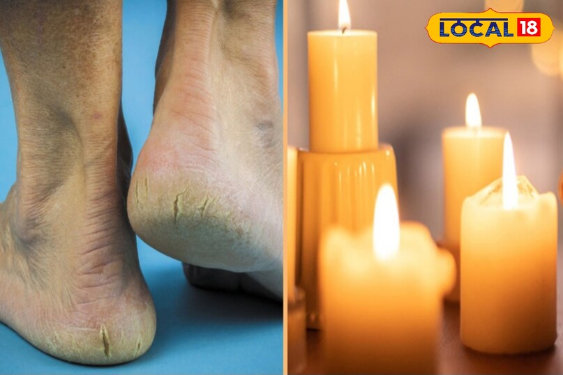 Repairing heels with candle and oil