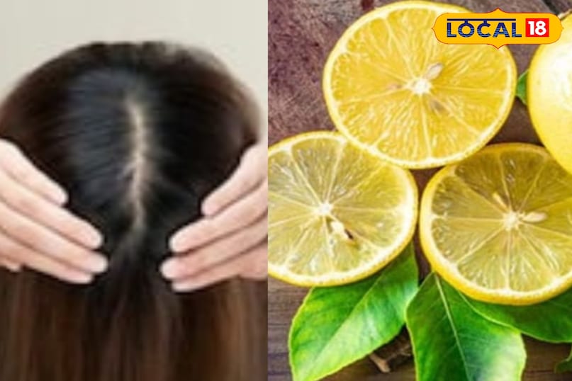 मेरठ, आयुर्वेद, नींबू, पत्ते, पेड़, विटामिन सी, बाल, त्वचा, उपयोग, लोकल -18,Meerut, Ayurveda, Lemon, Leaves, Tree, Vitamin C, Hair, Skin, Uses, Bharat.one मेरठ, आयुर्वेद, नींबू, पत्ते, पेड़, विटामिन सी, बाल, त्वचा, उपयोग, लोकल -18,Meerut, Ayurveda, Lemon, Leaves, Tree, Vitamin C, Hair, Skin, Uses, Bharat.one