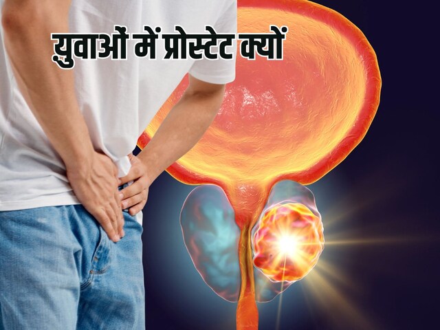 30 की उम्र से पहले क्यों होने लगा है प्रोस्टेट कैंसर, एक्सपर्ट ने बताया कारण