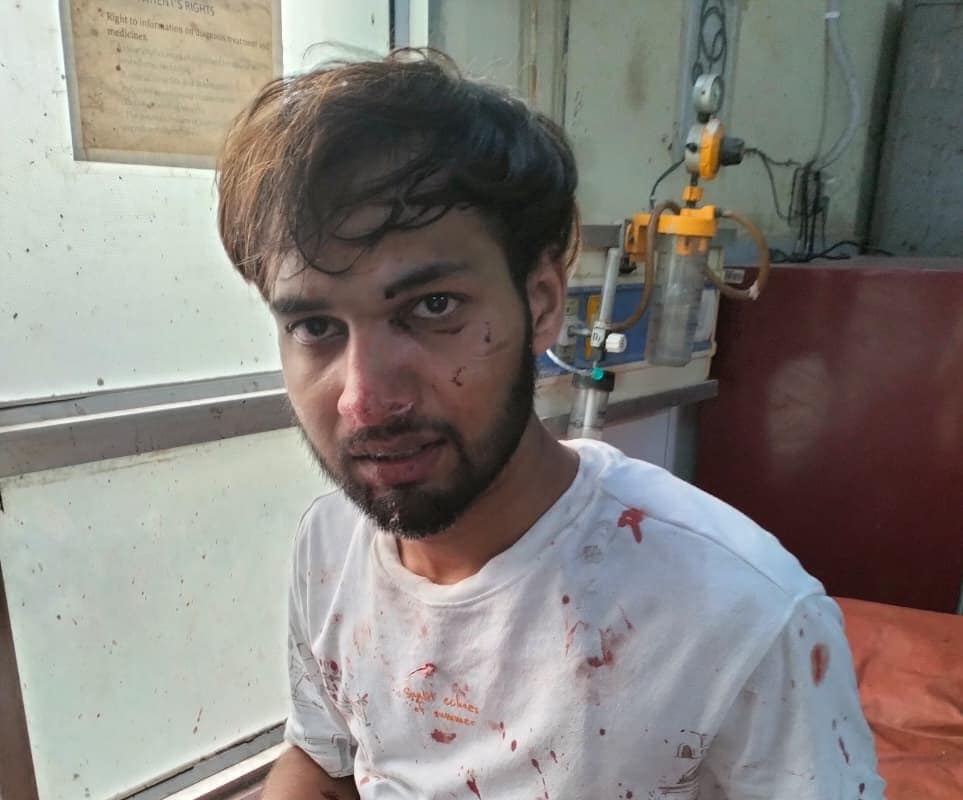 कहासुनी से बढ़ा विवाद मेडिकल कॉलेज में भिड़े छात्र चीख-पुकार से गूंजा कैंपस