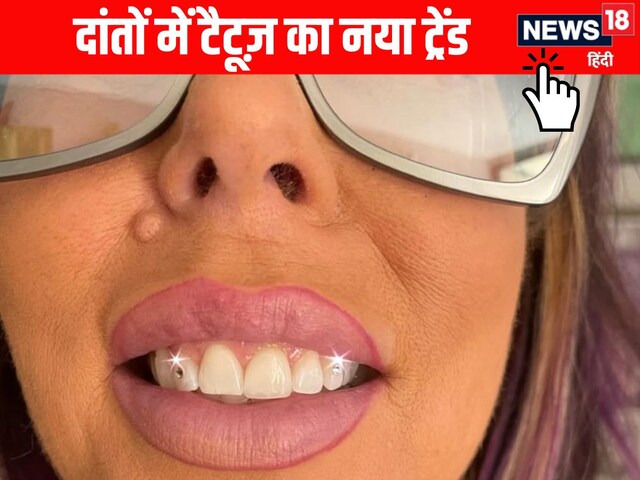 Unique new trend: Craze of 'tooth tattoo' increased among youth in China!