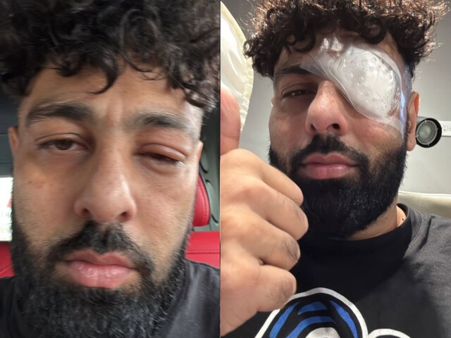 बादशाह का बिगड़ा चेहरा, आंख का हुआ बुरा हाल, पट्टी देख देख टेंशन में आए फैंस