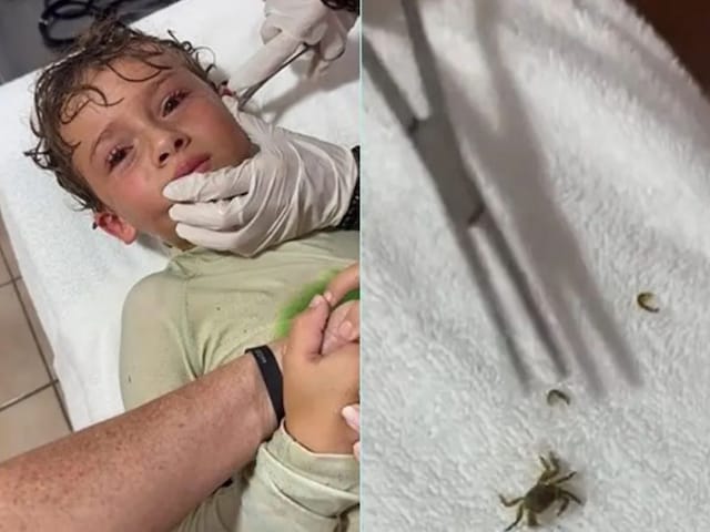As soon as the son's ear came out of the sea, the mother went to shock as soon as she peeps!