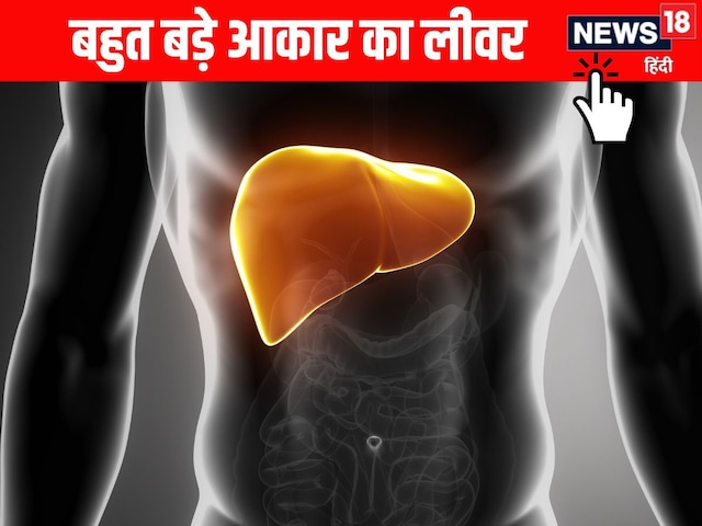 Women's hospitalized due to drinking more alcohol, seeing the liver, the doctors flew away