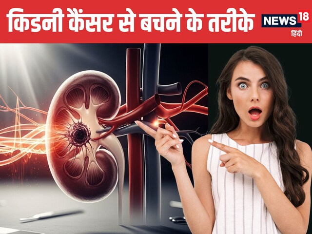 अगले 25 साल में दोगुने हो जाएंगे किडनी कैंसर के मरीज, ये 5 लक्षण न करें इग्नोर