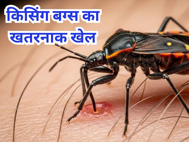 किसिंग बग्स से अमेरिका में हड़कंप, रात में इंसान का खून चूसता है यह पैरासाइट किसिंग बग्स से अमेरिका में हड़कंप, रात में इंसान का खून चूसता है यह पैरासाइट